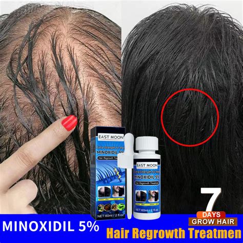 hairtech hair grower|Best hair growth serums 2022 UK: 6 that actually work。